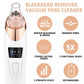 GlowPurify™ - Electric Blackhead Remover & Skin Enhancer